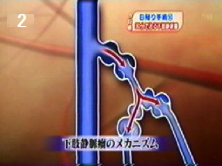 下肢静脈のメカニズム2