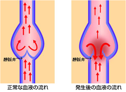 血液の流れ