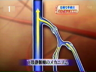 下肢静脈のメカニズム1